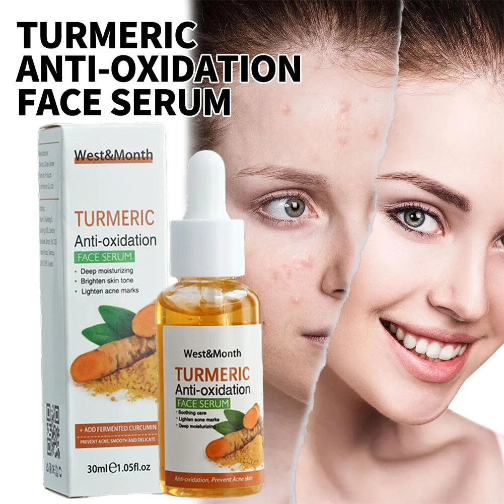 30ml Turmeric Freckle Whitening Serum Anti-oxidant Nourishing Moisturizing Repair Skin Brighten Fade Dark Spot Essence Face Care