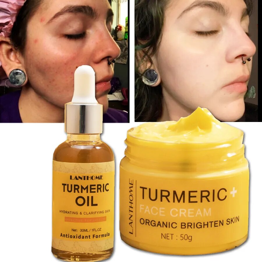 Turmeric Skin Care Set Shrink Pores Moisturizing Whitening Facial Oils Nourish Smooth Face Acne Brightening Cream For Age Spots