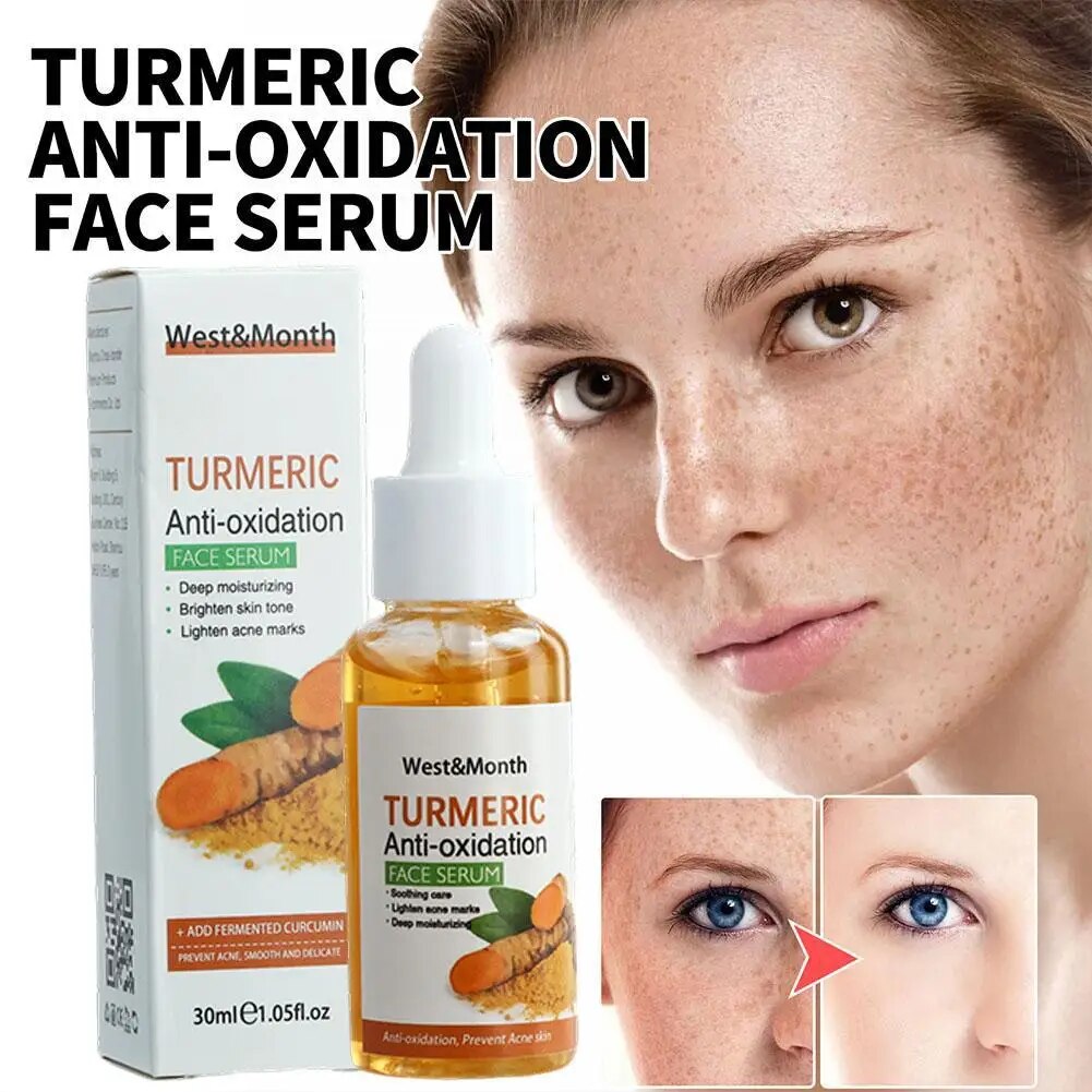 30ml Turmeric Freckle Whitening Serum Anti-oxidant Nourishing Moisturizing Repair Skin Brighten Fade Dark Spot Essence Face Care